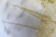 Cheilymenia coprinaria