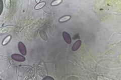 Ascobolus furfuraceus
