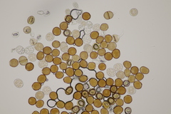 Puccinia calcitrapae
