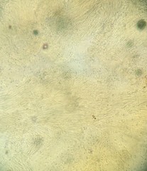 Polycephalomyces formosus