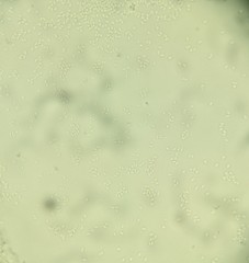 Polycephalomyces formosus