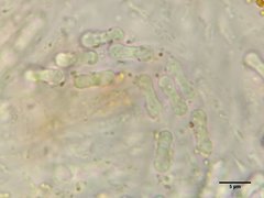 Bryocentria brongniartii