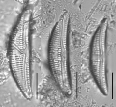 Amphora copulata
