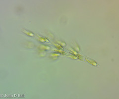 Dinobryon sertularia