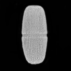 Actinotaenium silvae-nigrae