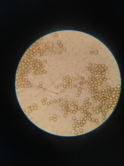 Perichaena quadrata