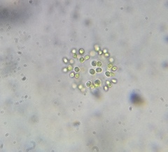 Dictyosphaerium