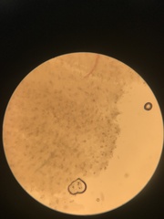Hohenbuehelia angustata