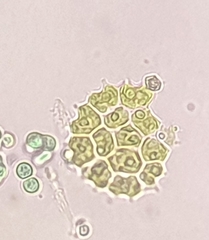 Pseudopediastrum