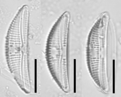 Amphora copulata