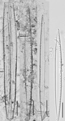 Nitzschia capitellata