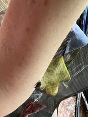 Homalodisca vitripennis