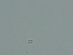 Dacryobolus karstenii