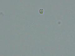 Dacryobolus karstenii