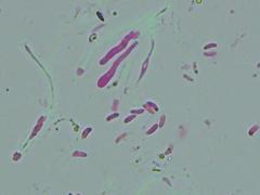 Dacryobolus karstenii