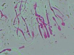 Dacryobolus karstenii