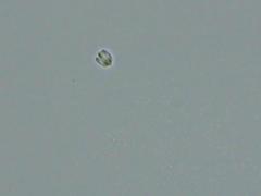 Dacryobolus karstenii