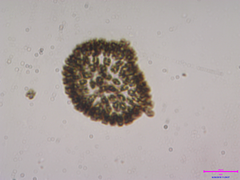 Woronichinia