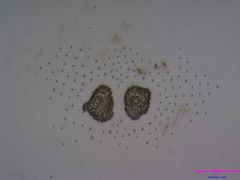 Woronichinia