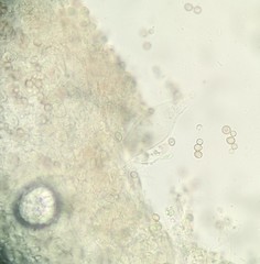 Amanita longistriata