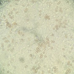 Amanita longistriata