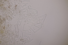 Ramularia primulae