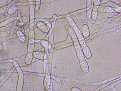 Golovinomyces cichoracearum