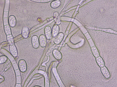 Golovinomyces cichoracearum