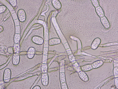 Golovinomyces cichoracearum