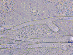 Golovinomyces cichoracearum