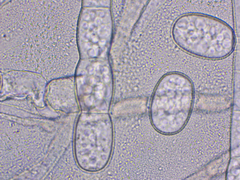 Golovinomyces cichoracearum