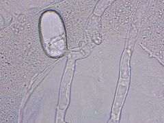Golovinomyces cichoracearum