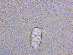 Golovinomyces cichoracearum