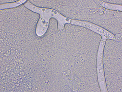 Golovinomyces cichoracearum