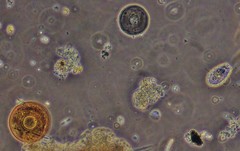 Euglypha