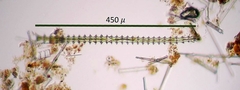 Triploceras gracile