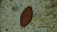 Trichuris vulpis