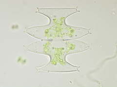 Micrasterias pinnatifida