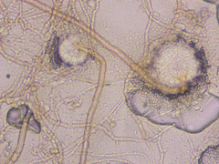 Aspergillus