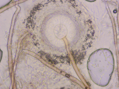 Aspergillus