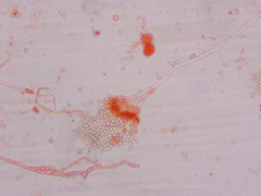 Penicillium