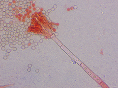 Penicillium