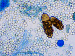 Alternaria