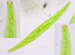 Closterium striolatum