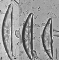 Amphora copulata