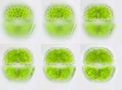 Cosmarium margaritiferum