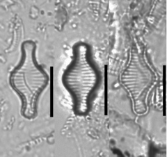 Staurosira construens