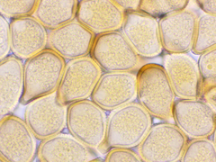 Cumminsiella mirabilissima