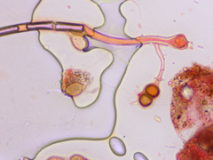 Cumminsiella mirabilissima