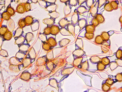 Cumminsiella mirabilissima